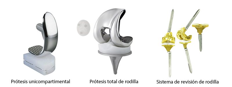 prótesis de rodilla y sus clases