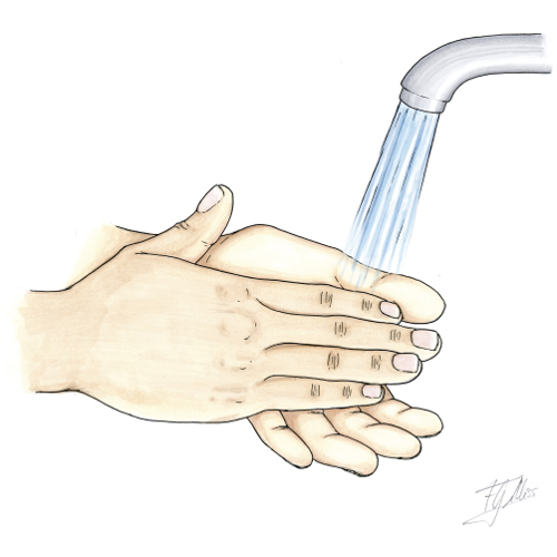 Cuidados de los tornillos para huesos: desinfección de manos